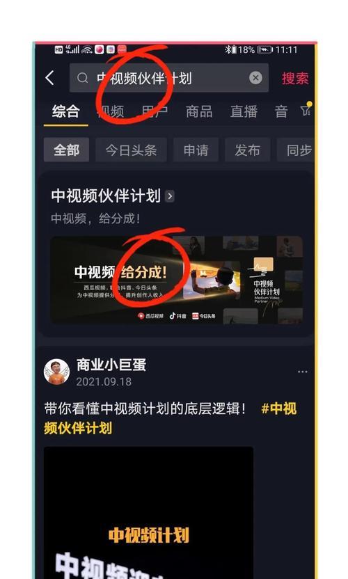 抖音好友推荐关闭方法大全（详细介绍抖音好友推荐关闭方法）